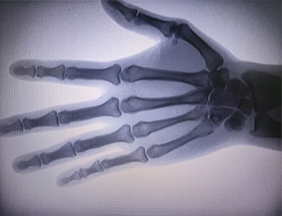 The screen can display the palm of the hand The screen can display the palm of the hand