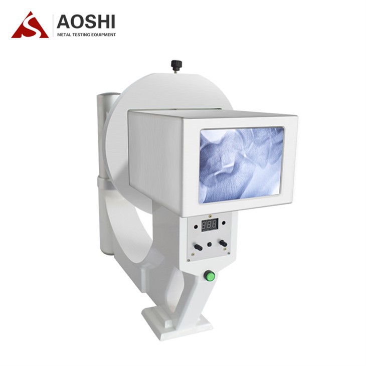 Ekstremitalarning rentgenogrammasi